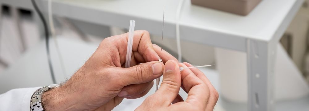 Cardiologist holds a catheter explaining the procedure options for treating Afib and reducing stroke risk